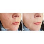 Shiseido Benefiance Nutriperfect Day Cream SPF15 - Image 6