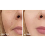 Elizabeth Arden Prevage Anti-Aging Daily Serum - Image 7