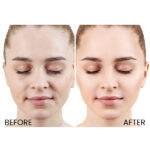 Estée Lauder Nightly Renewal Skincare Set - Image 6