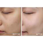 Kose - Cosme Decorte Lift Dimension Brighten+Plump Care Set - Image 5