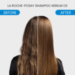 La Roche-Posay Kerium DS Intensive Anti-Dandruff Shampoo - Image 5