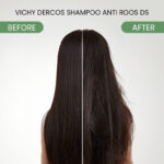 Vichy Dercos Anti-Dandruff DS Active Shampoo for Normal to Oily Hair - Image 5