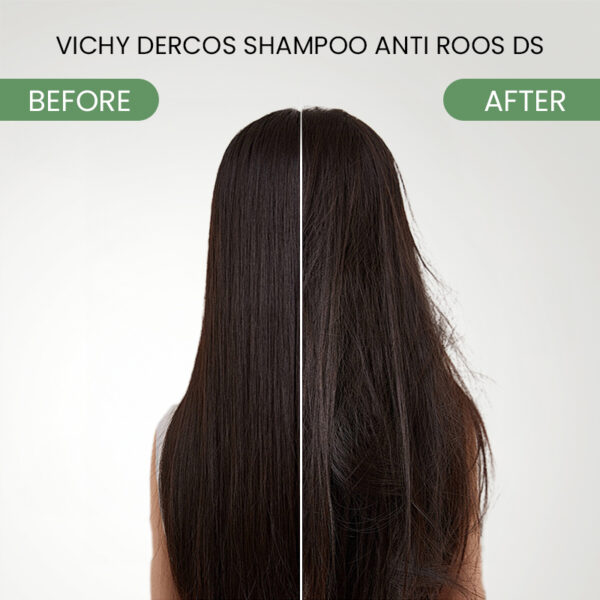 Vichy Dercos Anti-Dandruff DS Active Shampoo for Normal to Oily Hair - Image 5