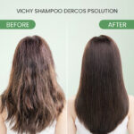 Vichy Dercos Psolution Anti-Dandruff Shampoo for Psoriasis - Image 6