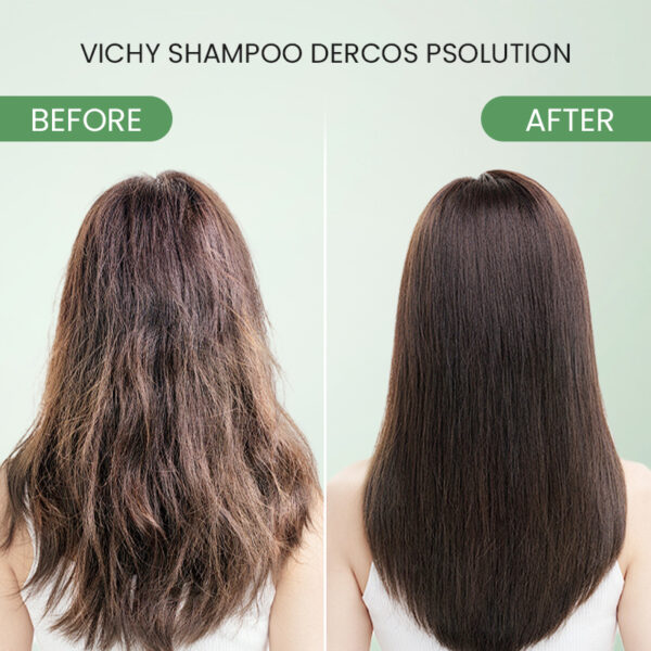 Vichy Dercos Psolution Anti-Dandruff Shampoo for Psoriasis - Image 6