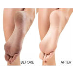 CeraVe SA Renewing Foot Cream - Image 6