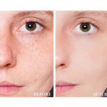 CeraVe Concentrated Blemish Control Gel Anti-Imperfections - Image 6