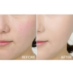 Eucerin Oil Control Sun Gel-Cream Dry Touch SPF 30 - Image 6