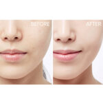 CeraVe Moisturizing Lotion for Dry to Very Dry Skin - Image 5