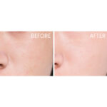 Nuxe Super Serum [10] The Universal Age-Defying Concentrate - Image 8