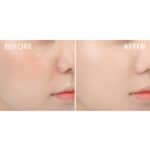 Eucerin Dry Skin Replenishing Face Day Cream 5% Urea - Image 6