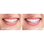 APAGARD® PREMIO Toothpaste - Image 6