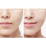 Hada Labo Gokujyun Premium Hyaluronic Acid Lotion - Image 5