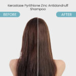 Kérastase Symbiose Bain Crème Anti-Dandruff Shampoo - Image 5