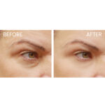 Filorga NCEF-Reverse Eyes Supreme Multi-Correction Eye Cream - Image 6