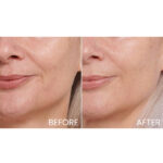 Filorga Time Filler 5XP Correction Cream Anti-Wrinkle - Image 5