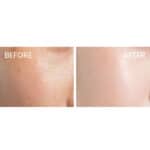 Biretix Focus Gel Blemish Reducer Face Gel - Image 6