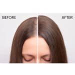 Iraltone Anti-Hair Loss Lotion - Image 6