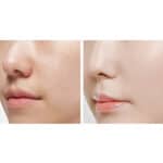 Medicube Zero Pore Pad 2.0 - Image 5