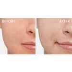 ISDIN Fotoultra 100 Spot Prevent Fusion Fluid SPF50+ - Image 6