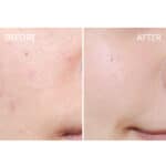 La Roche-Posay Effaclar Duo+M Crème - Image 6