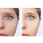 SKIN1004 Madagascar Centella Hyalu-Cica Blue Serum - Image 6