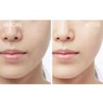 SKIN1004 Madagascar Centella Hyalu-Cica Cloudy Mist - Image 6