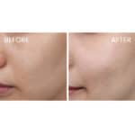 SKIN1004 Madagascar Centella Hyalu-Cica First Ampoule - Image 7