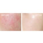 SKIN1004 Madagascar Centella Tea-Trica B5 Cream - Image 6
