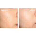 SKIN1004 Madagascar Centella Tone Brightening Boosting Toner - Image 6