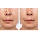 Medik8 Crystal Retinal 6 - Image 6