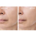 Medik8 Crystal Retinal 10 - Image 6