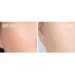 Medik8 Hydr8 B5 Intense Serum - Image 6