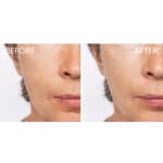 Shiseido White Lucent Illuminating Micro‑Spot Serum - Image 7