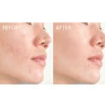 Caudalie Vinopure Blemish Control Salicylic Serum - Image 6