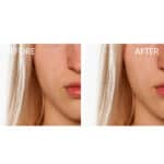 Eucerin DermoPurifyer Triple Effect Serum - Image 6