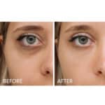 Nuxe Nuxuriance Ultra The Eye and Lip Contour Cream - Image 6