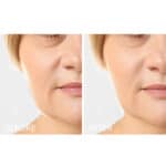 Caudalie Vinoperfect Instant Brightening Moisturizer - Image 6