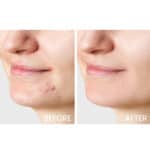 Caudalie Vinopure Moisturizing Mattifying Fluid - Image 6