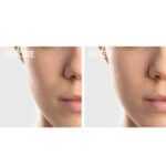 StriVectin Anti-Wrinkle Smooth & Plump Kit - Image 6