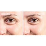 StriVectin Super-C Eye Vitamin Eye Cream - Image 6