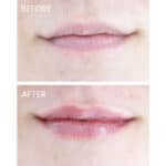 StriVectin Double Fix for Lips Plumping & Vertical Line Treatment - Image 6