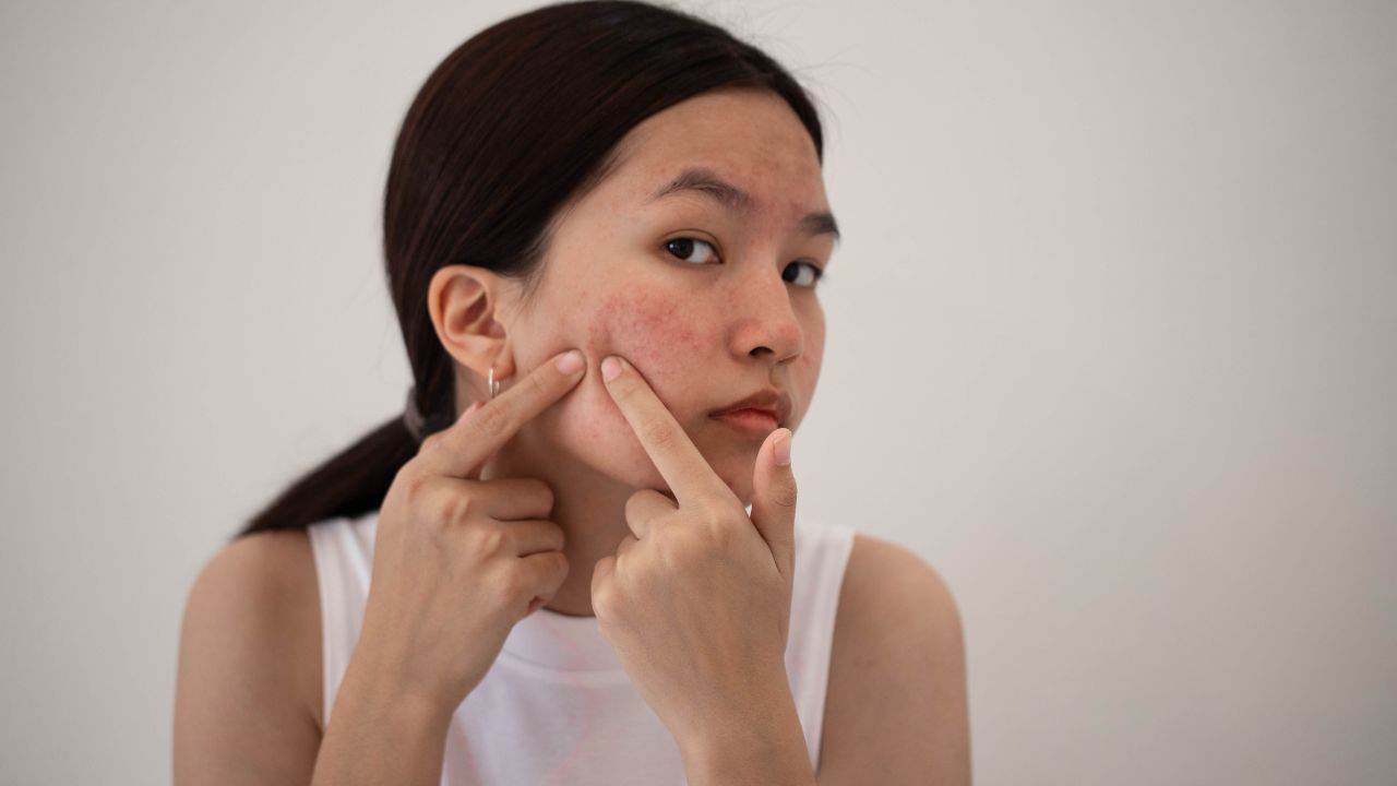 Benefits of Glycolic Acid for Your Skin