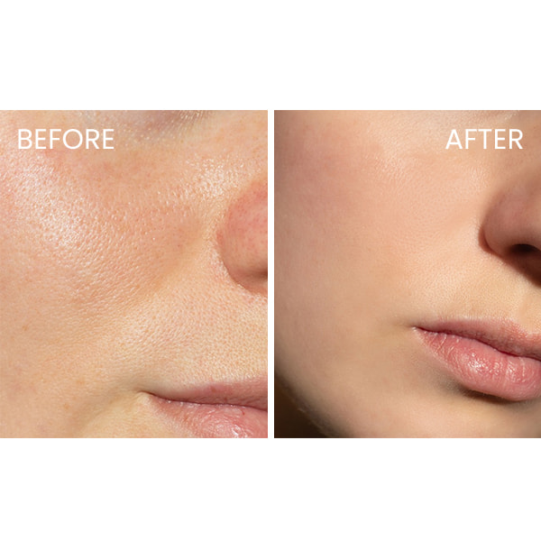 1639.4 CeraVe Oil Control Gel Cream - Image 5