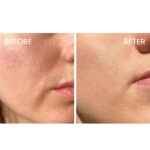 La Roche-Posay Toleriane Dermallergo Cream - Image 6