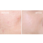 La Roche-Posay Effaclar DUO +M Unifiant Creme - Image 7