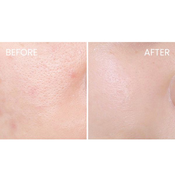1642.5 La Roche-Posay Effaclar DUO +M Unifiant Creme - Image 7