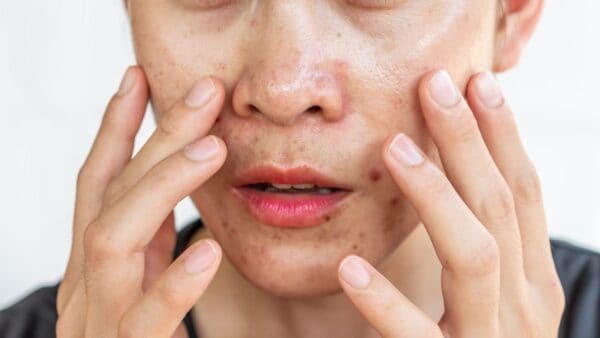How to Get Rid of Oily Skin: Top Tips and Products
