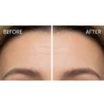 Alwa skincare treatment - A high-end skincare product available at Beautinow.