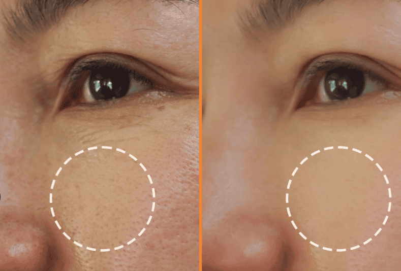 What Is Vitamin C Serum?